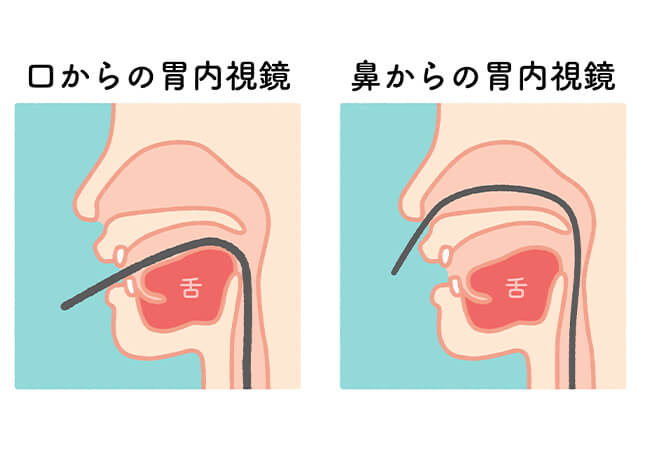 土井クリニックの胃カメラ検査
